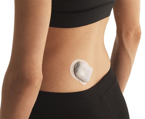 The Omnipod 5 System is the only tubeless automated insulin delivery system integrated with Dexcom G6 CGM to manage blood glucose with no multiple daily injections, zero fingersticks* and is fully controlled by a compatible personal smartphone.** Omnipod 5 consists of the tubeless and waterproof † Omnipod 5 Pod, the Omnipod 5 App with …